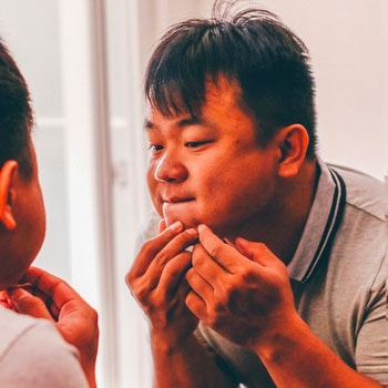 Asian man popping pimple on his chin